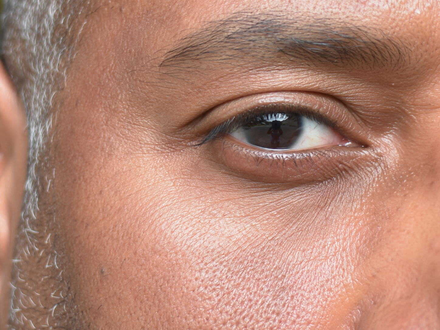 Default iPhone camera — skin smoothed and waxy, pores reduced, under-eye flattened.